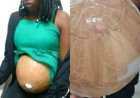Woman Allegedly Caught Smuggling Drugs by Faking Pregnancy